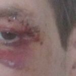 டொராண்டோ நகரின் மையப்பகுதியில் மக்களை தாக்கும் மர்ம நபர் – பாதசாரிகளுக்கு பொலிசார் எச்சரிக்கை!