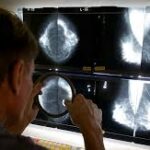 கனடாவில் சில வகை புற்றுநோய்களின் தாக்கம் அதிகரிப்பு!