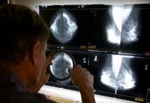 கனடாவில் சில வகை புற்றுநோய்களின் தாக்கம் அதிகரிப்பு!